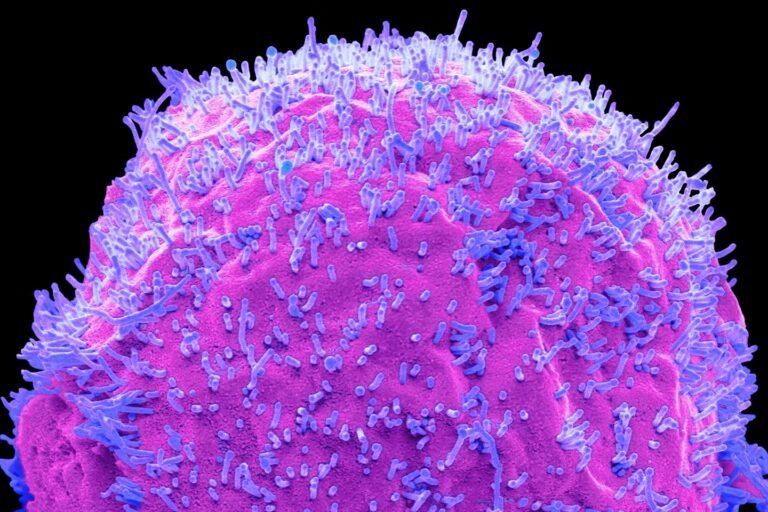 Grippe : ces « ruses » qui rendent le virus plus nocif