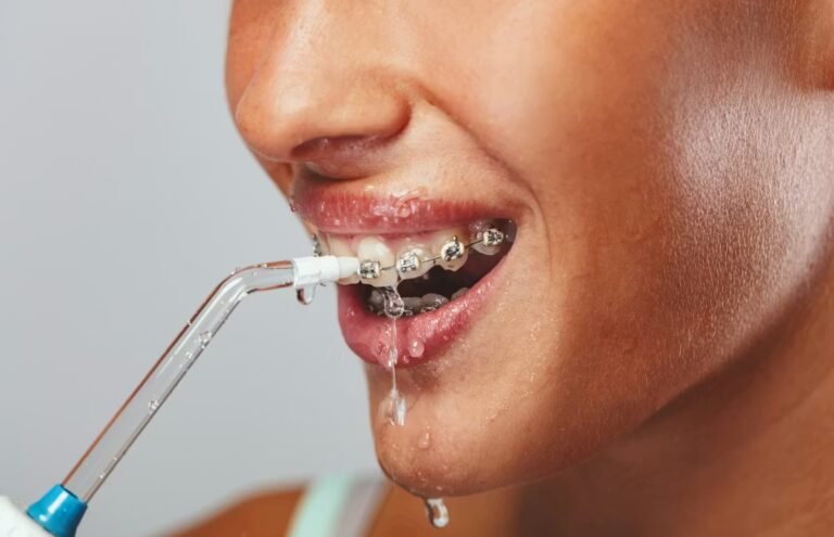 Hygiène des dents : un hydropulseur est-il vraiment utile ?