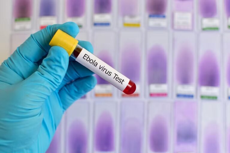 Anticorps, antiviral : comment un Américain atteint d'Ebola a été soigné avec succès en Allemagne