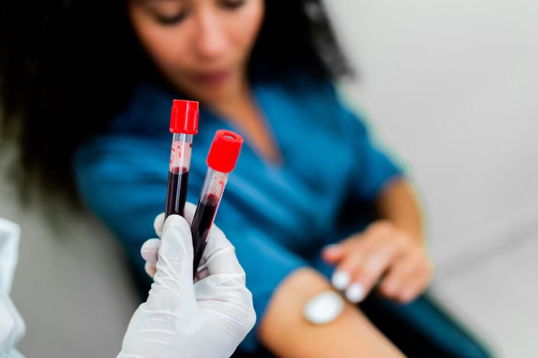 Trop de globules rouges dans le sang : faut-il s'inquiéter ?