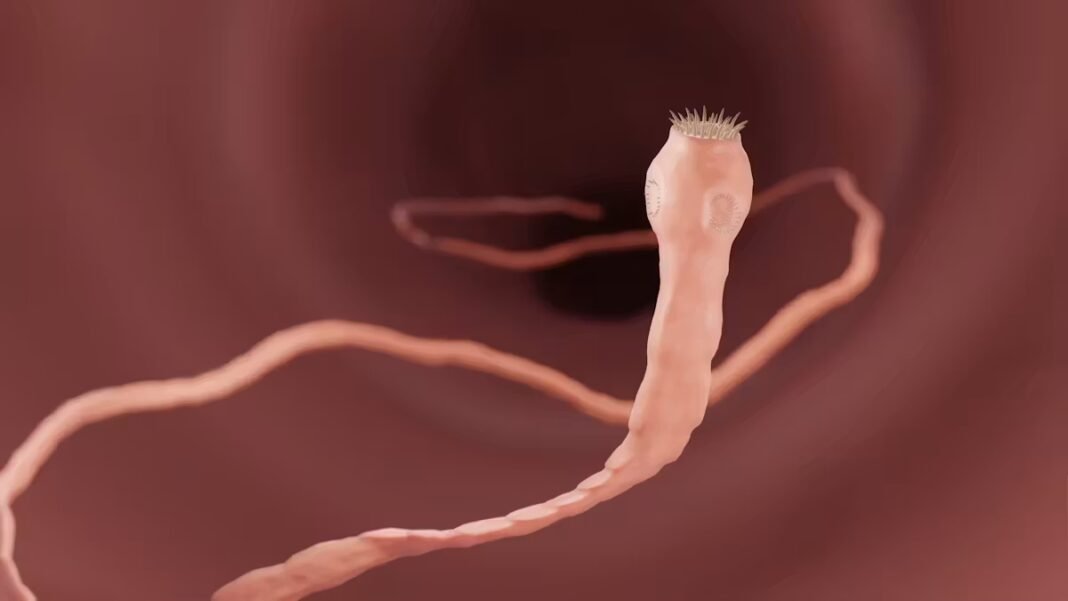 Après un voyage en Inde, elle se retrouve avec 38 parasites dans le cerveau