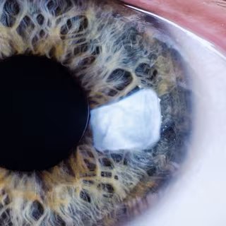 La photo de la semaine : c’est beau, on dirait du Pollock… jusqu’à ce que vous compreniez ce que c’est ! 3 L’iris est la zone colorée de l’œil, visible à l’avant. Il s’agit en fait de la partie antérieure de la tunique vasculaire (choroïde). L’iris possède une ouverture en son centre : la pupille, ronde, qui laisse passer la lumière. Le diamètre de la pupille peut varier, laissant plus ou moins entrer la lumière, en fonction de la luminosité ambiante. L’iris contient un pigment brun plus ou moins abondant.
© Mattis2412, CC by-sa 3.0