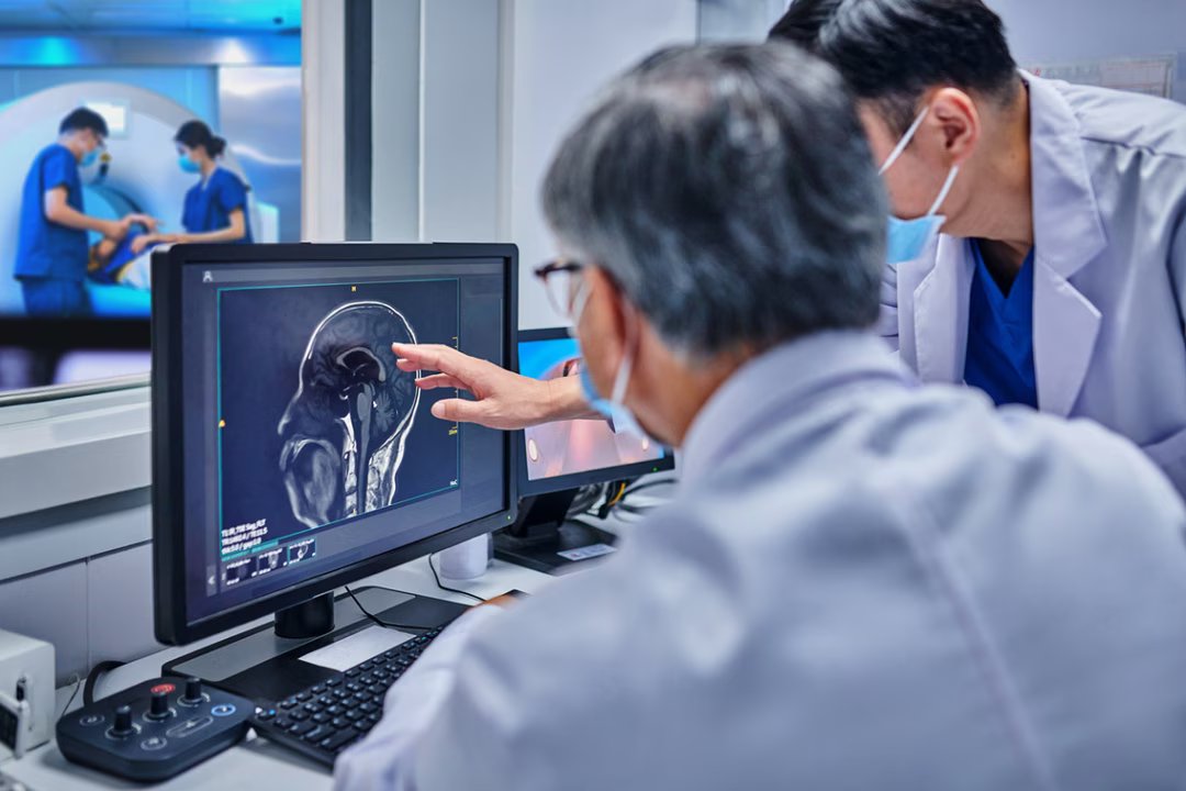 Et si la piste contre Alzheimer venait d'un acide aminé déjà connu ? 1 alzheimer acide amine complement alimentaire